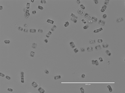 Diatom cells under microscope