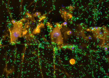 Winzige Meeresbewohner unter dem Fluoreszenzmikroskop: Algenzellen (blau) umgeben von Algen-abbauenden Bakterien (grün).