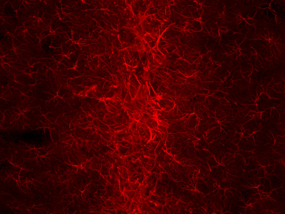 Astrocytes (GFAP) forming a glial scar after intracranial infusion