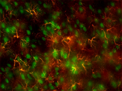 Neu-N (neurons) and GFAP (astrocytes), respectively, in the rat brain