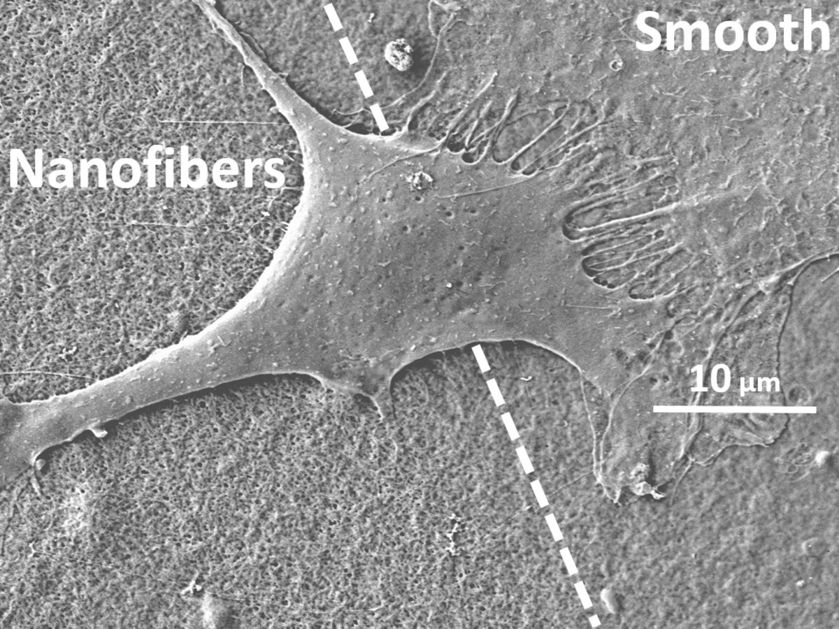 Fibroblast on nanofibers and smooth surface