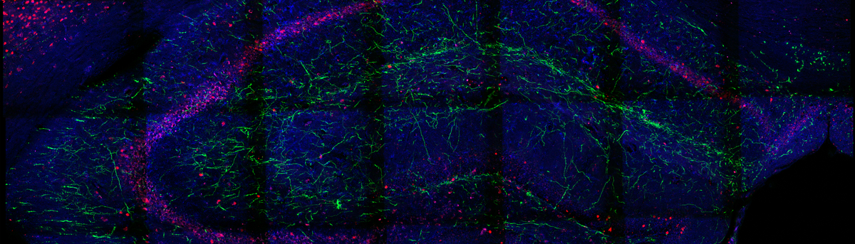 Hippocampus of an ePet-Cre mouse innervated via serotoneric axon terminals (green) and staining against glutamateric neurons (blue) and c-Fos (red)