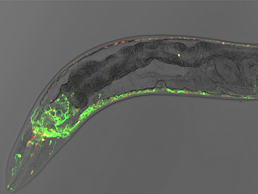 Microscopic image of a nematode.
