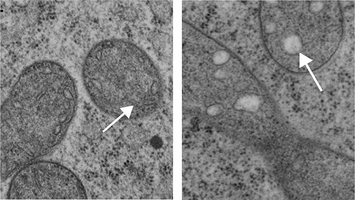 Mitochondria of wild-type (left) and syco-1 (right) central cells 2 d after emasculation. White arrow shows show normal (left) and aberrant (right) christae