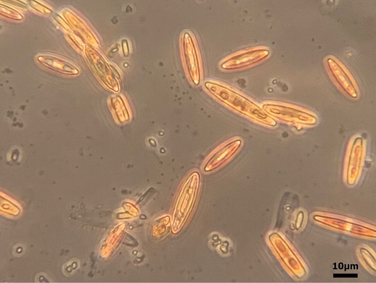 Natural benthic diatom sample from Helgoland under the microscope (400-fold magnification).