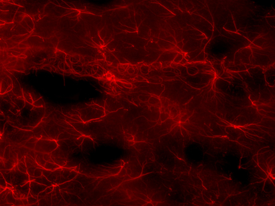 Astrocytes encircling a blood vessel