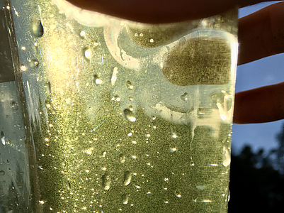 Diatoms (green specks) in water sample