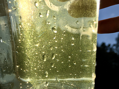 Diatoms in water sample Diatoms (green specks) in water sample