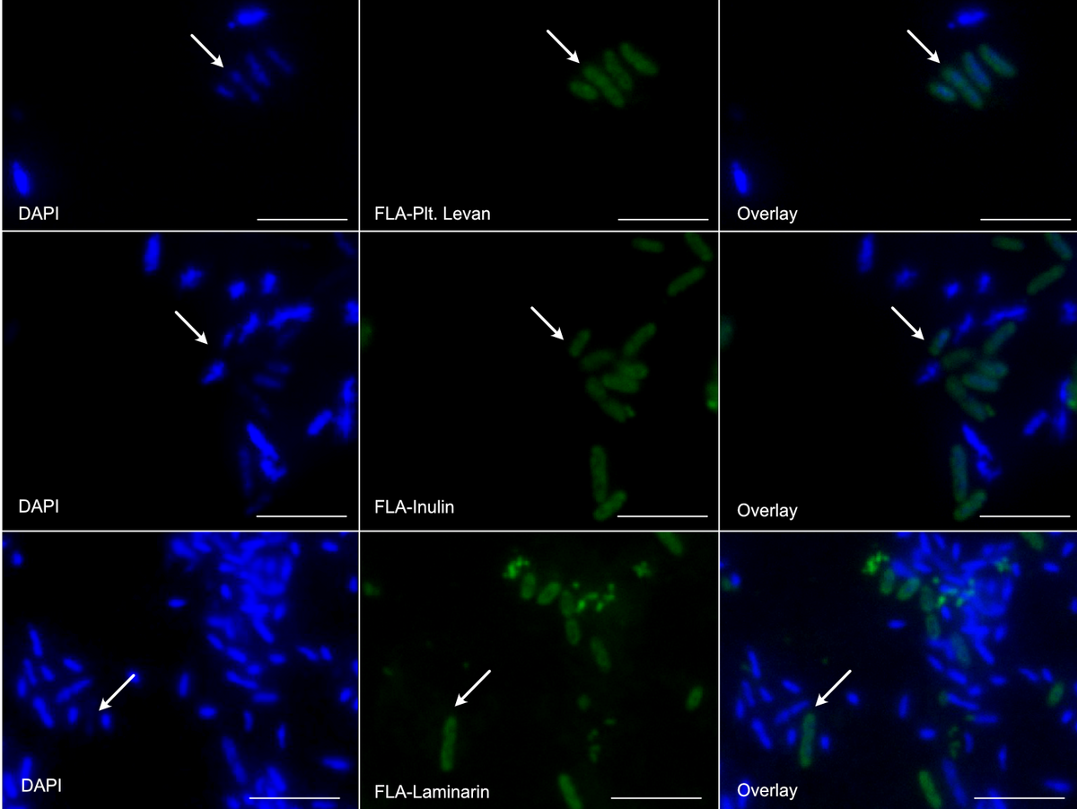Mikroskopieaufnahmen von Bakterien in blau und grün