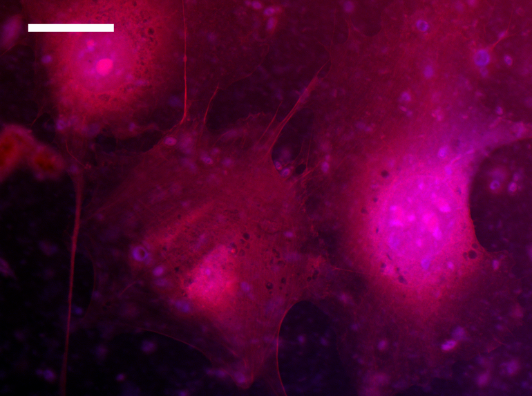 Fluorescence microscopy images of fibroblasts on collagen scaffolds