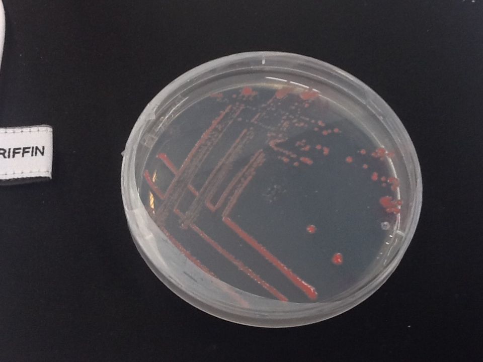Microbiology Bacterial Plate Bacteria on Agar plate