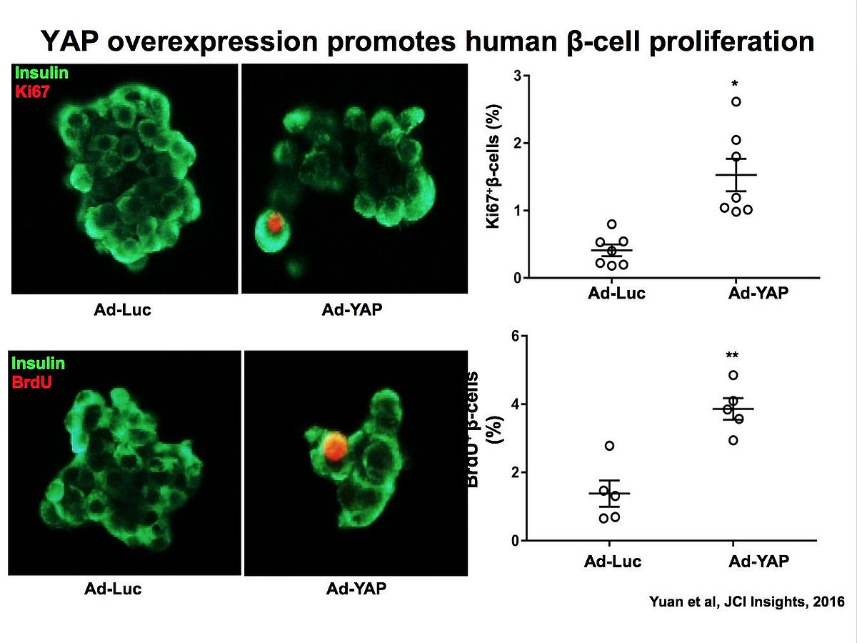 microscopic image of Pro-proliferative and anti-apoptotic action of exogenously introduced YAP in pancreatic β-cells